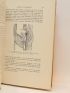 CARRASCO : Prolapsus du rectum - Signed book, First edition - Edition-Originale.com